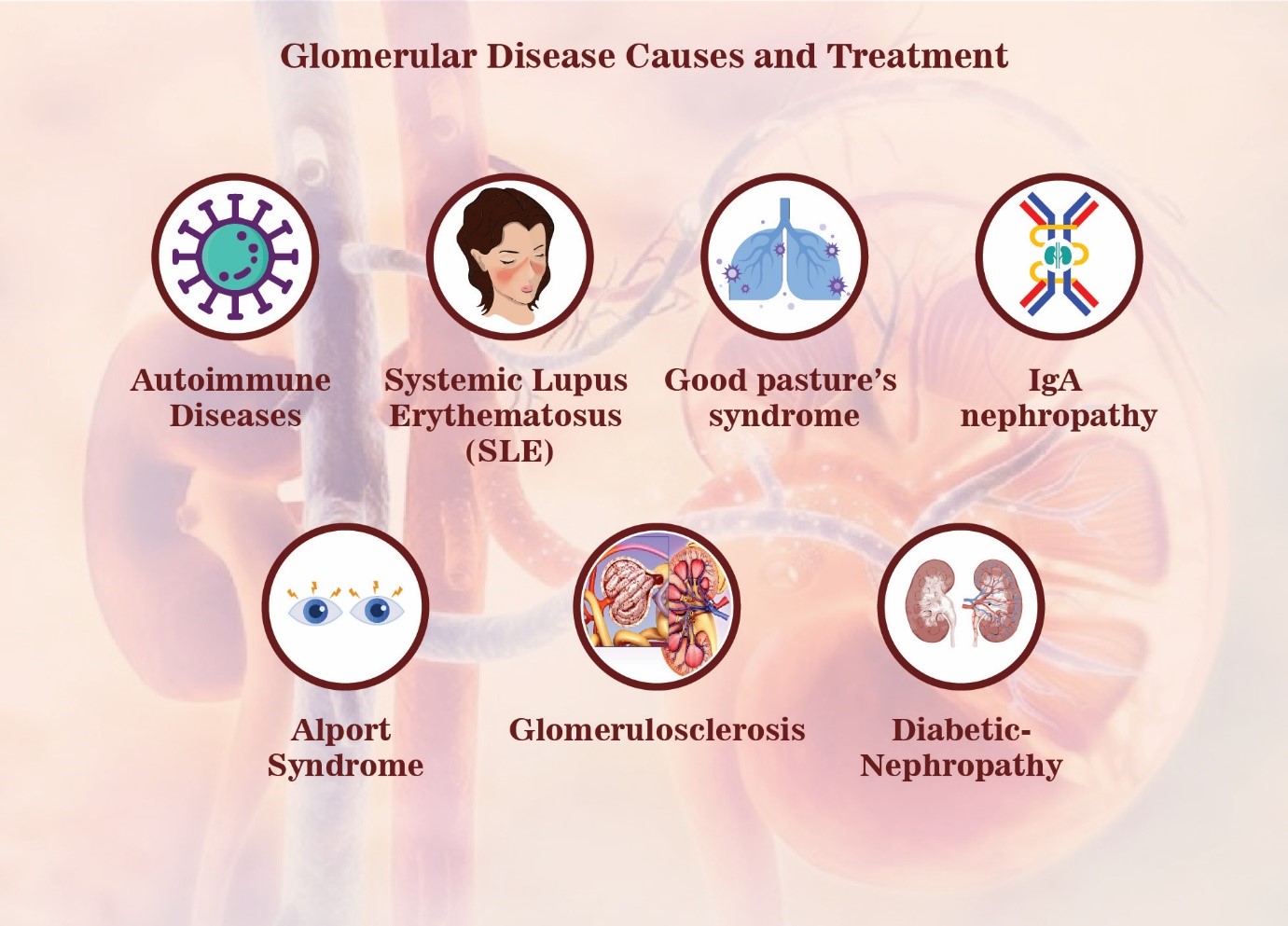 Causes of Glomercular Disease