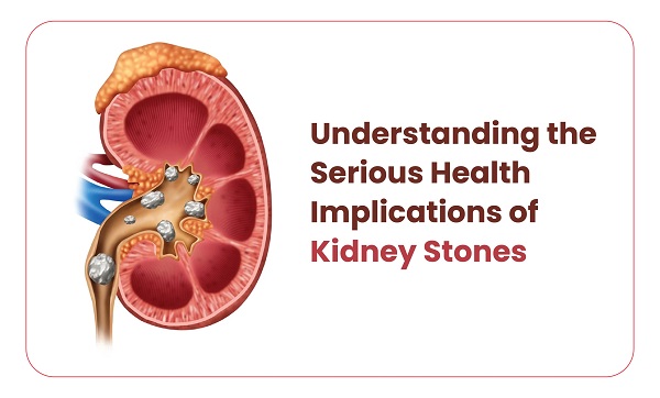 kidney stones treatment in Mumbai